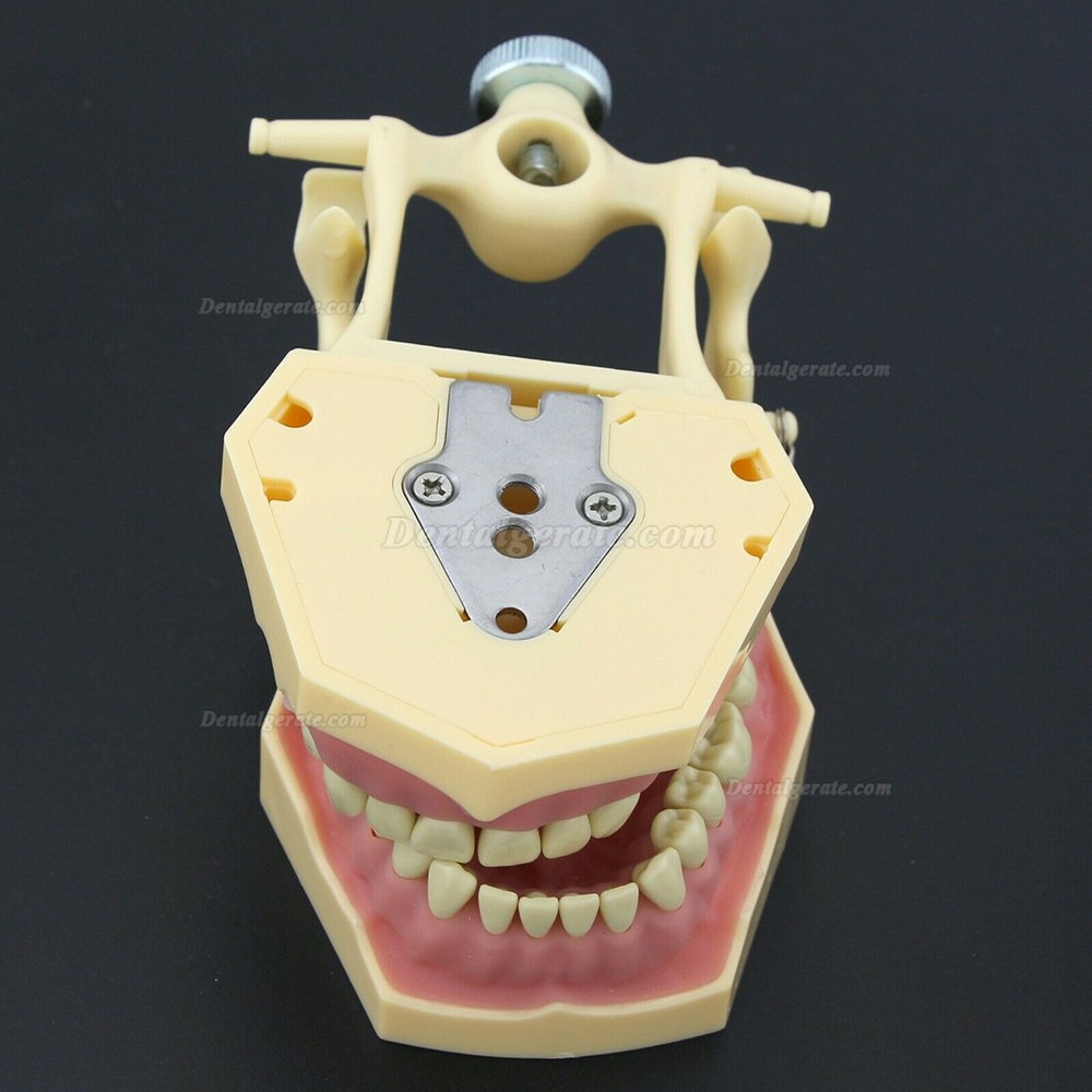 Dental Typodont Restorative Standardmodell M8014-2 Kompatibel mit Frasaco AG3 Modell